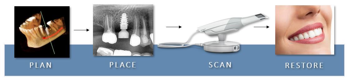 IMPLANT-FLOW-CHART-2